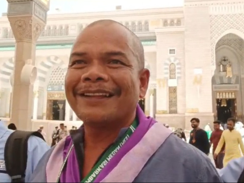 Petugas Haji Alami Luka Bakar di Kaki Akibat Panas Terik Saat Mengantar Jemaah